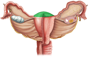 Fundus of uterus (#3929)
