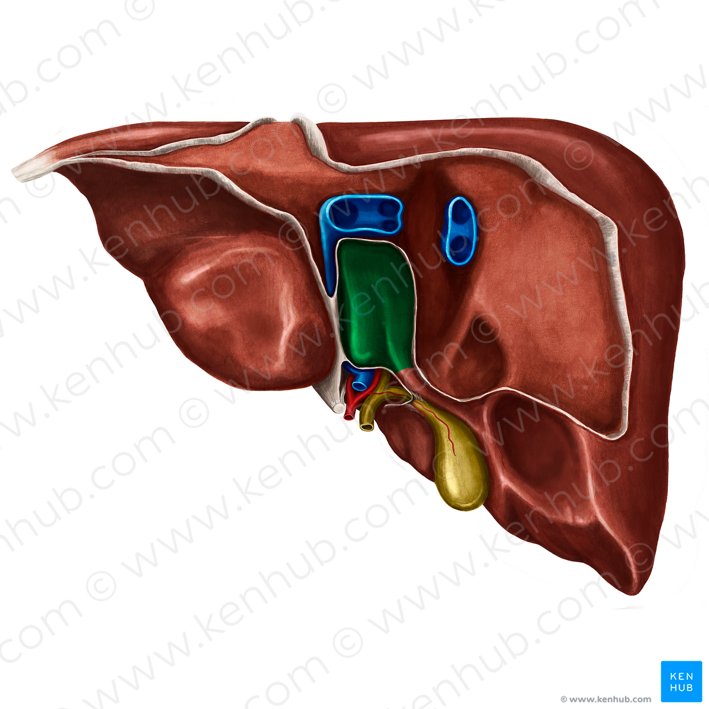 Caudate lobe of liver (#4777)