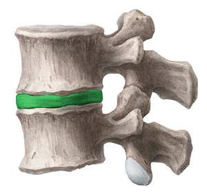 Intervertebral disc (#3273)