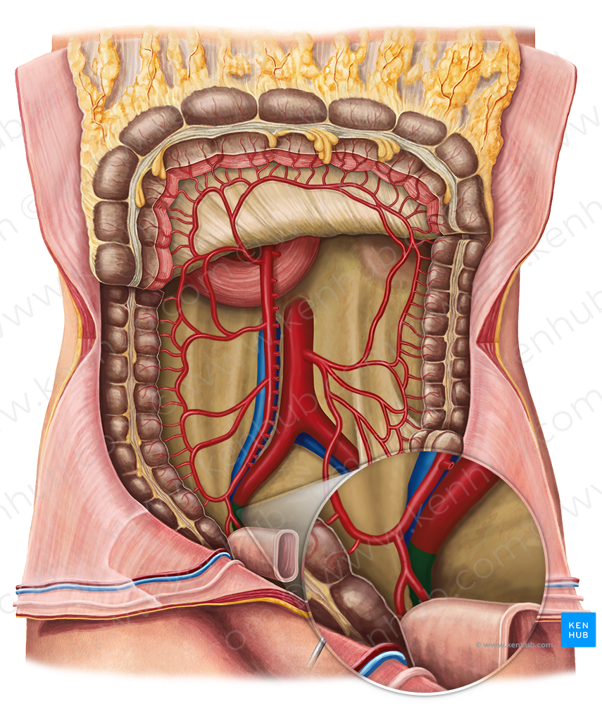 Internal iliac artery (#1423)