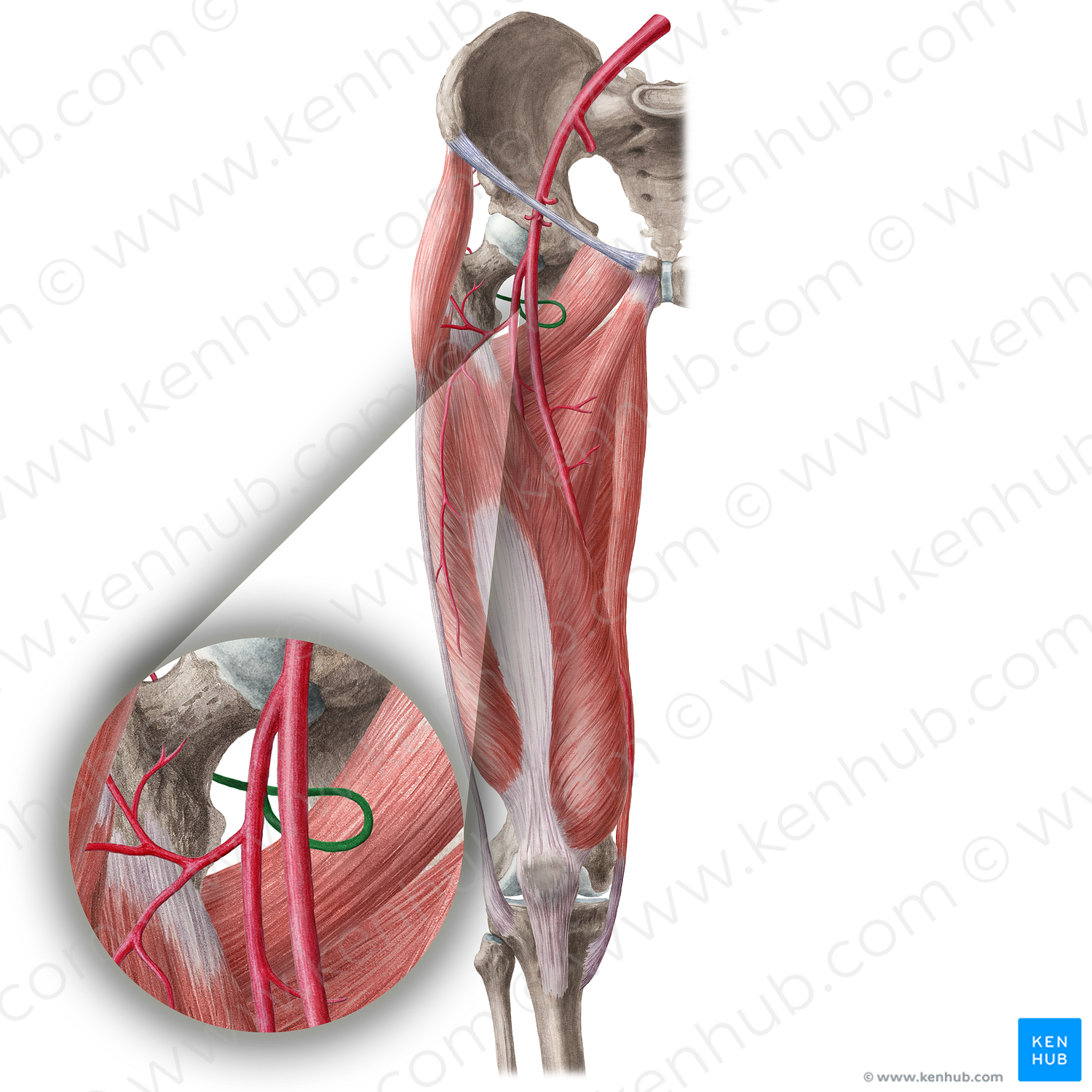 Medial circumflex femoral artery (#1035)
