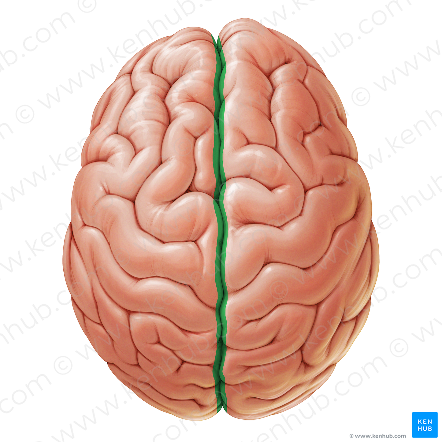 Longitudinal cerebral fissure (#19056)