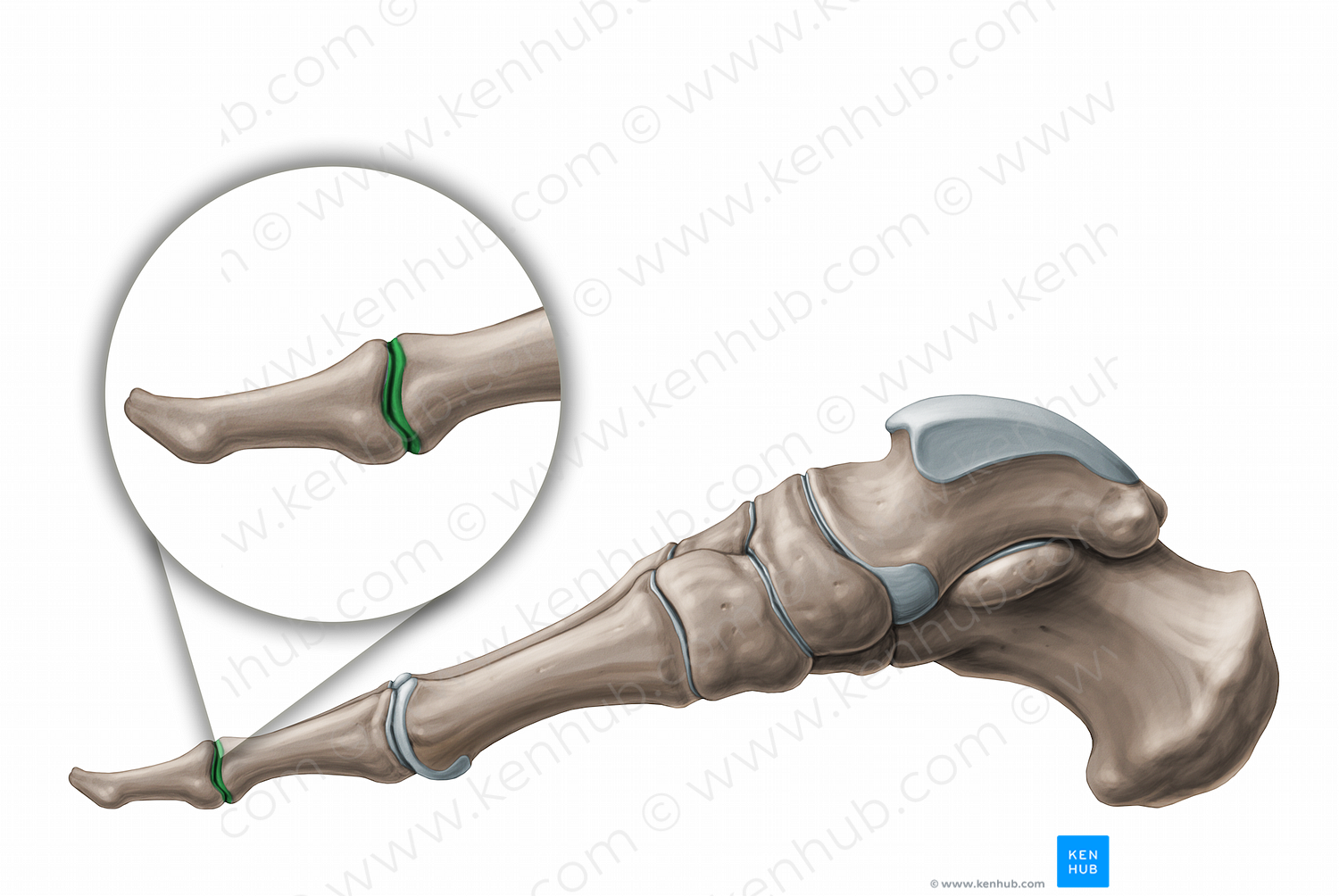 Interphalangeal joints of foot (#11240)