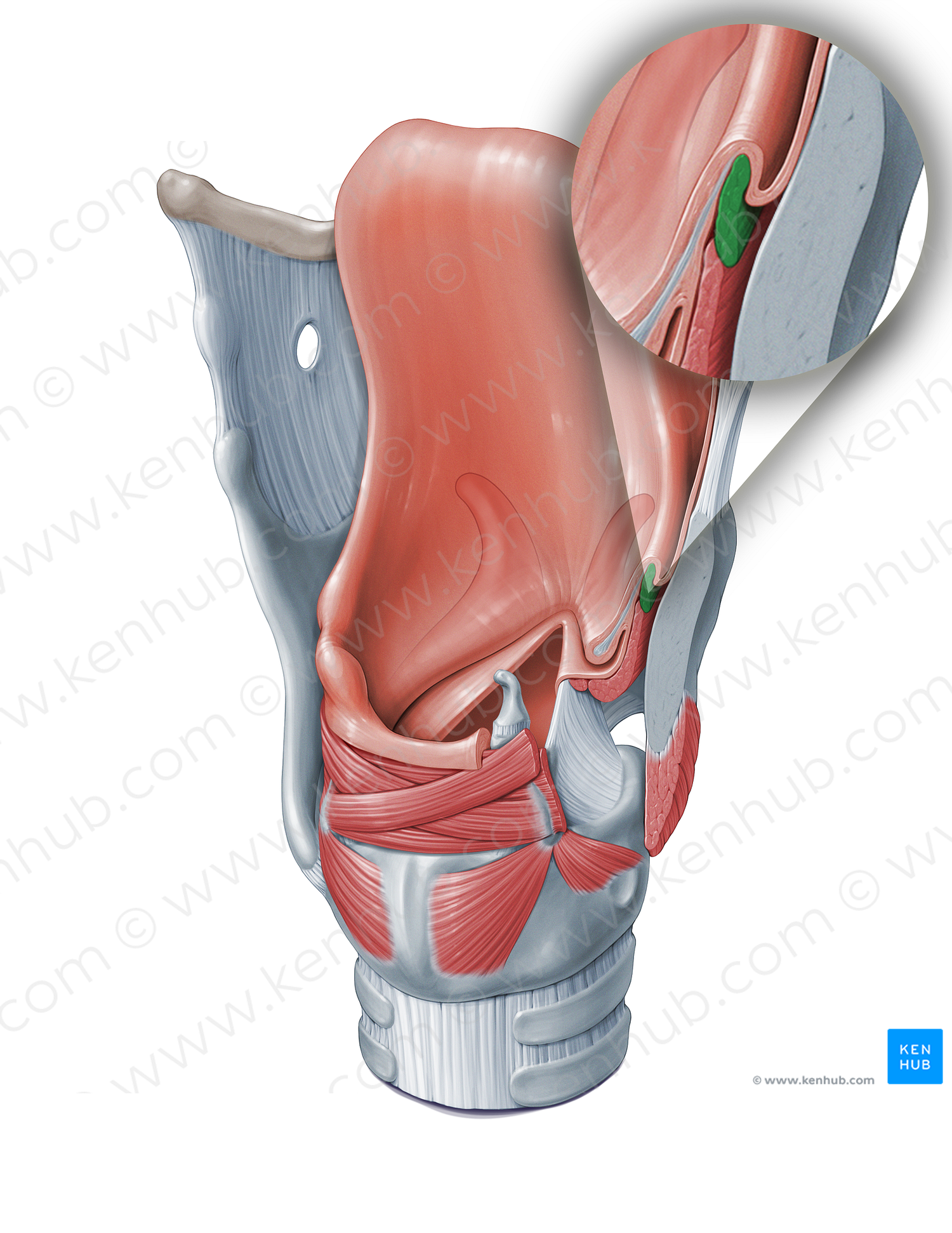 Aryepiglottic muscle (#18347)