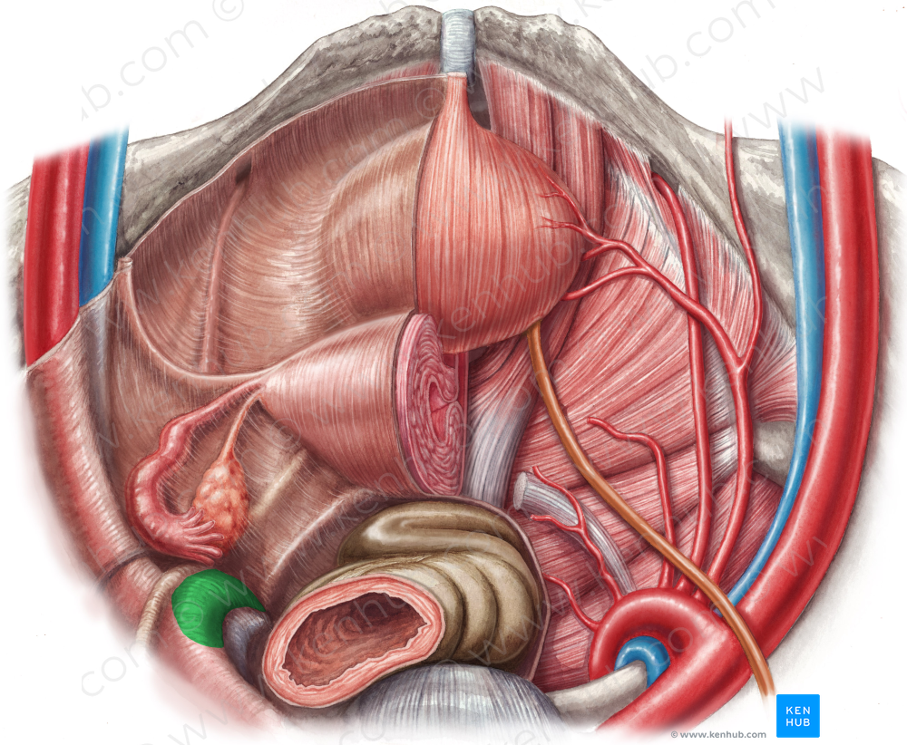 Left internal iliac artery (#1435)