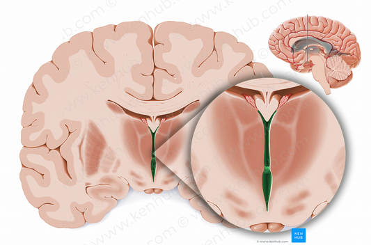 Third ventricle (#11885)