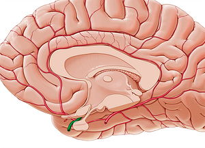 Right internal carotid artery (#991)