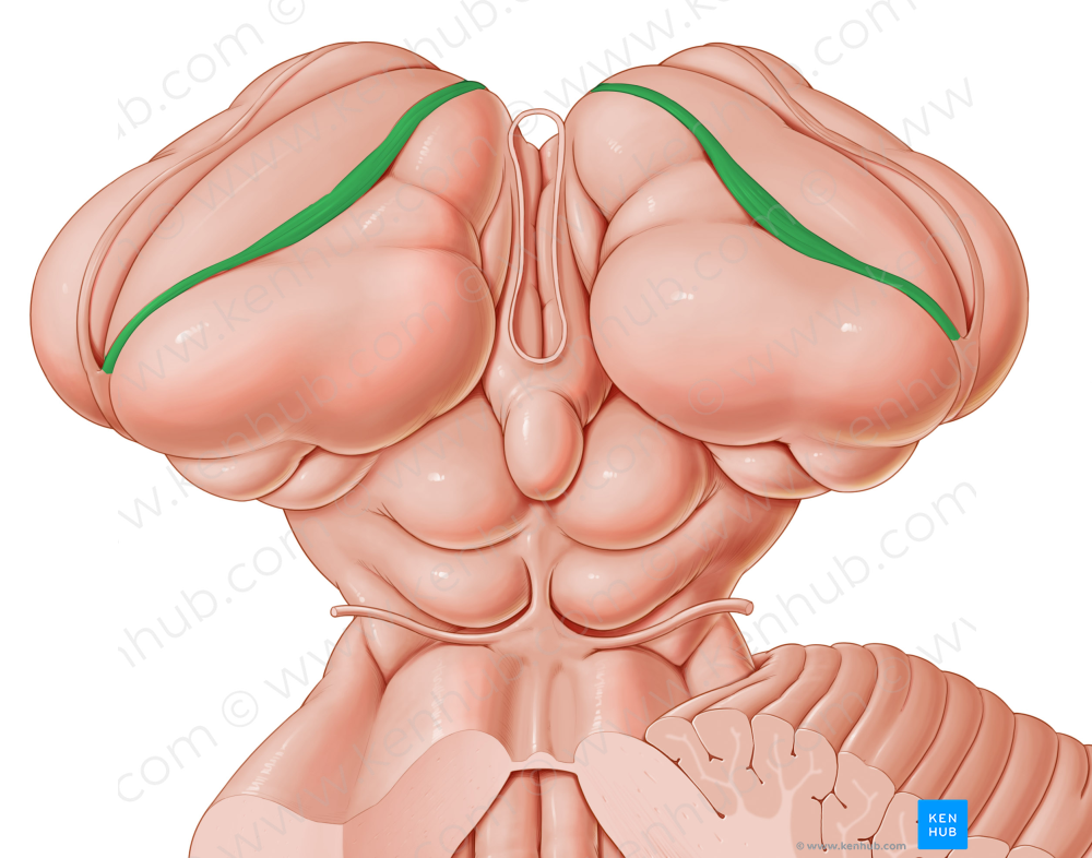 Choroid line (#4369)