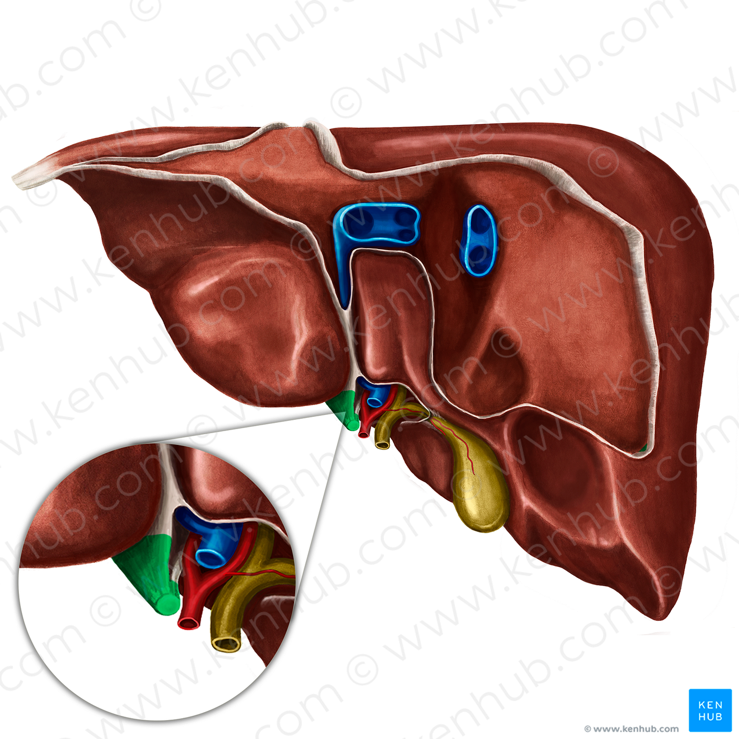 Round ligament of liver (#4630)