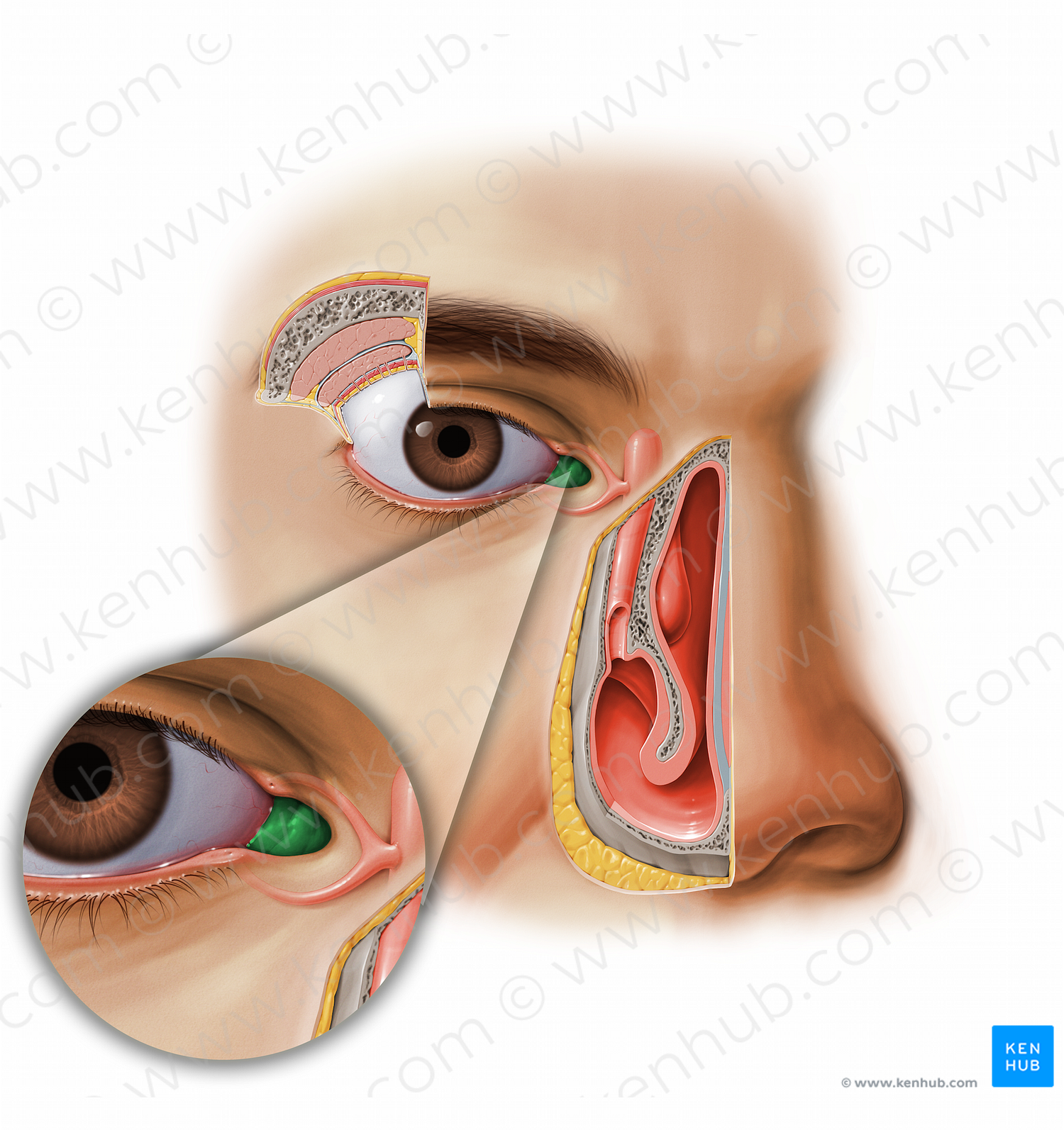 Lacrimal caruncle (#11611)