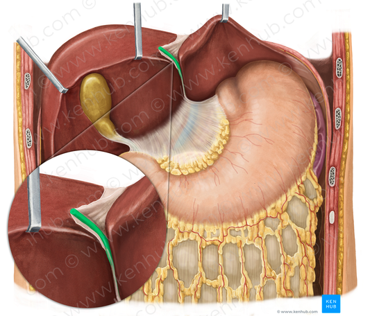 Round ligament of liver (#4628)