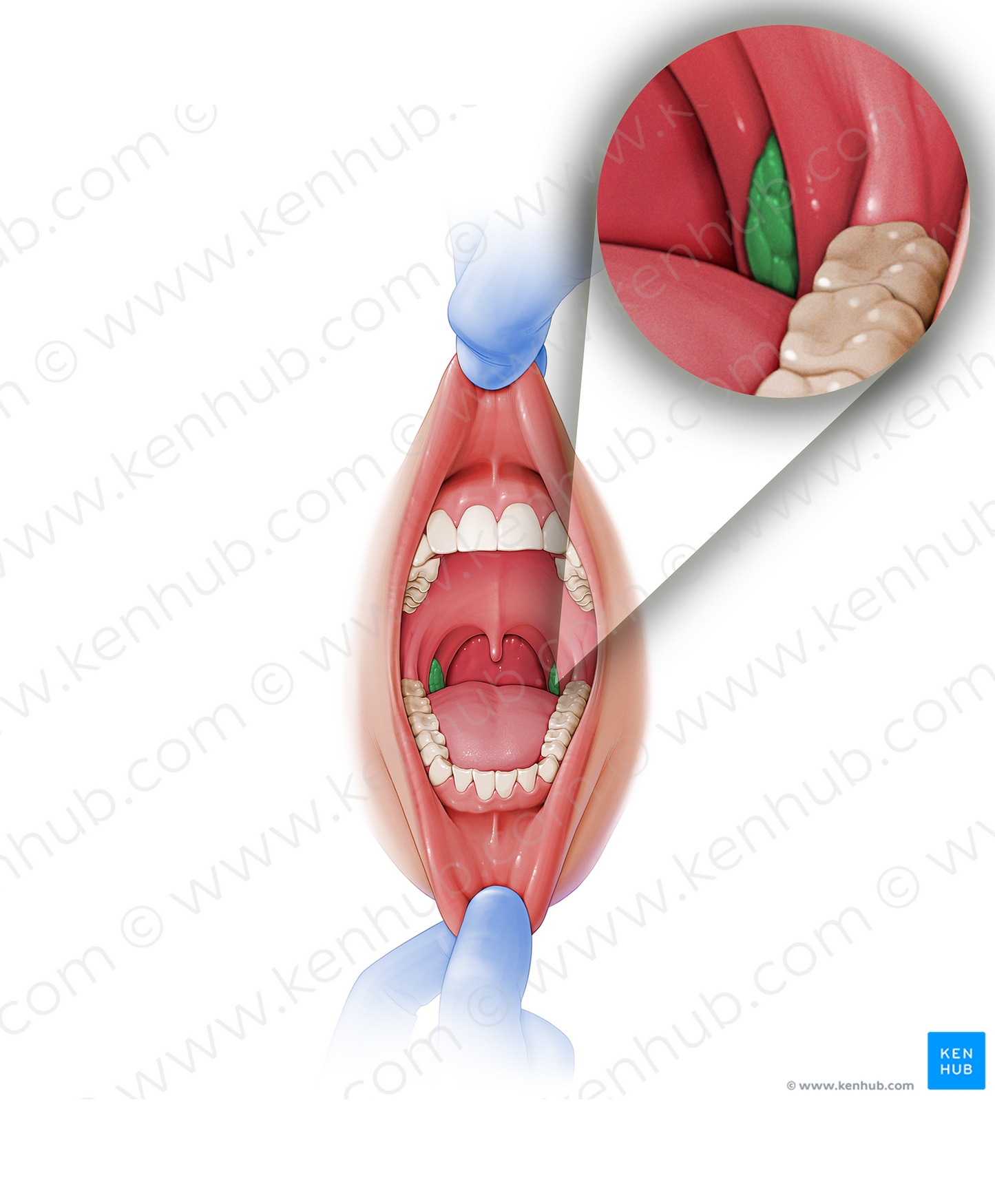 Palatine tonsil (#9473)