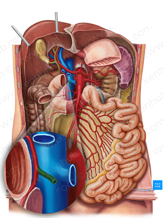 Right gastroomental artery (#1305)