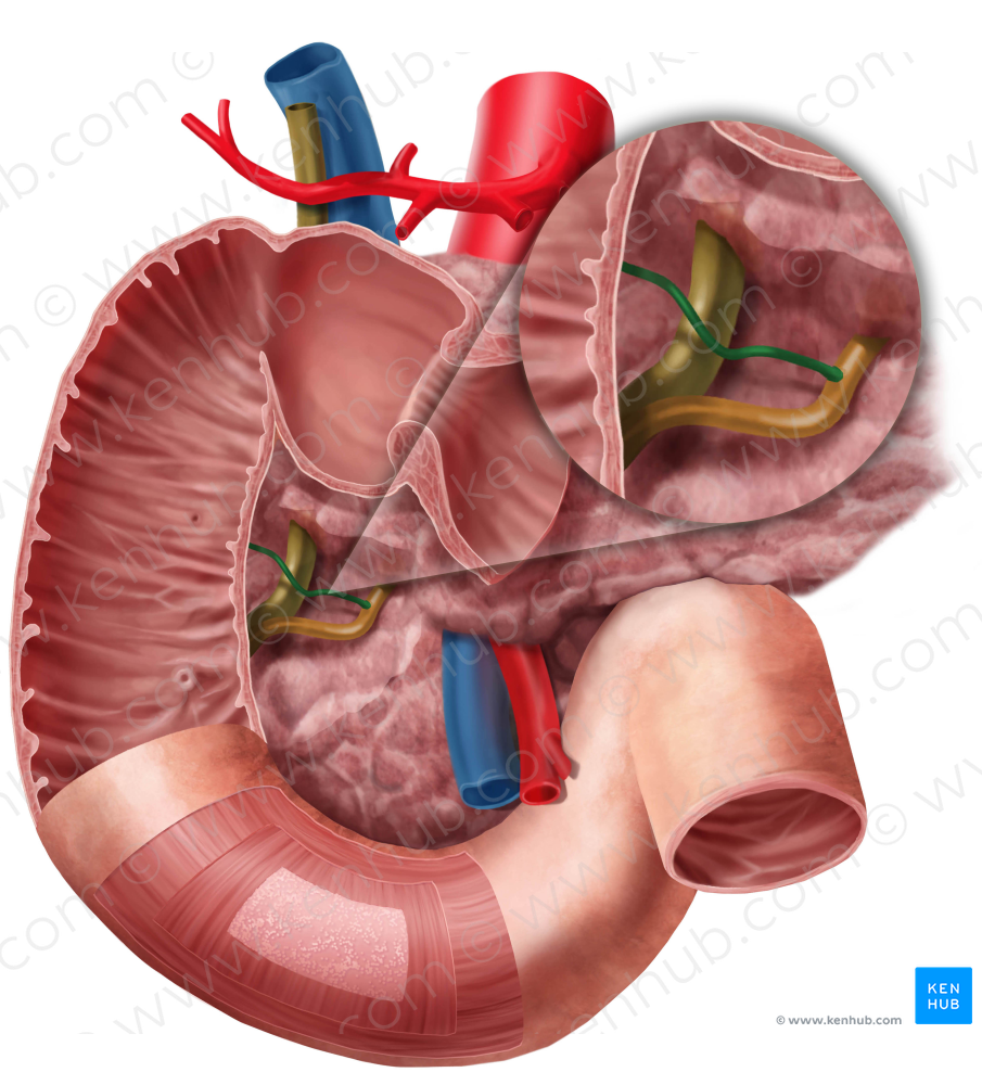 Accessory pancreatic duct (#3337)