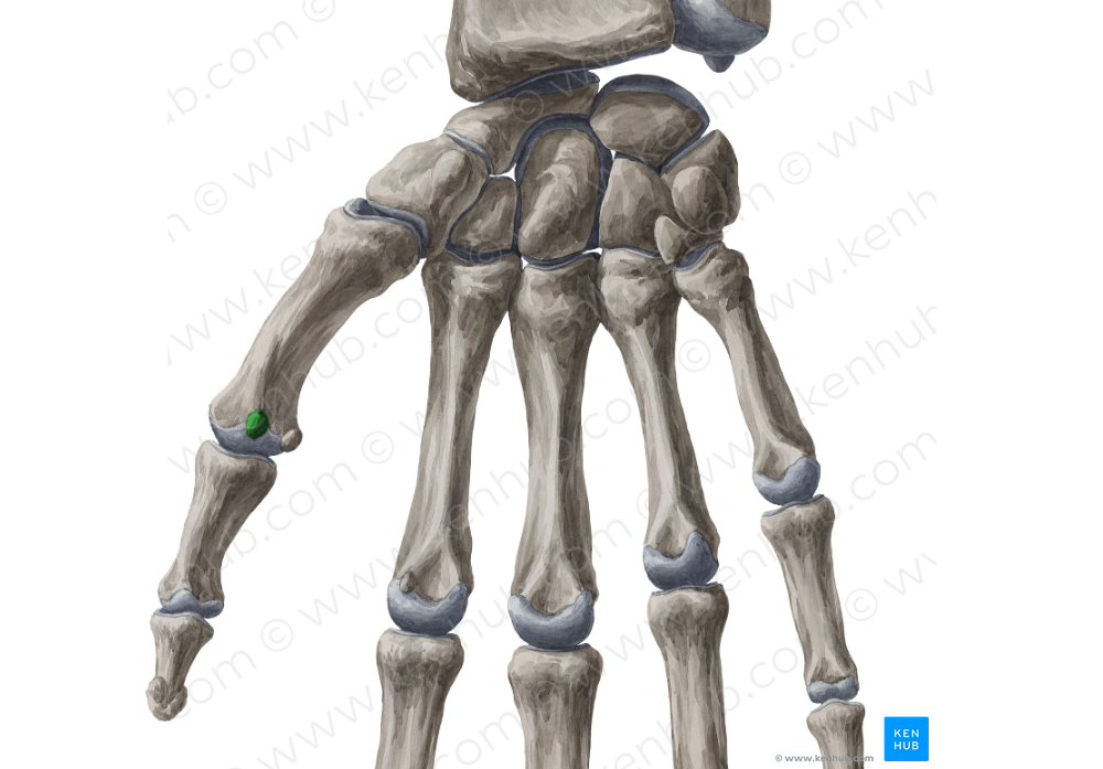Radial sesamoid bone of metacarpophalangeal joint of thumb (#7507)