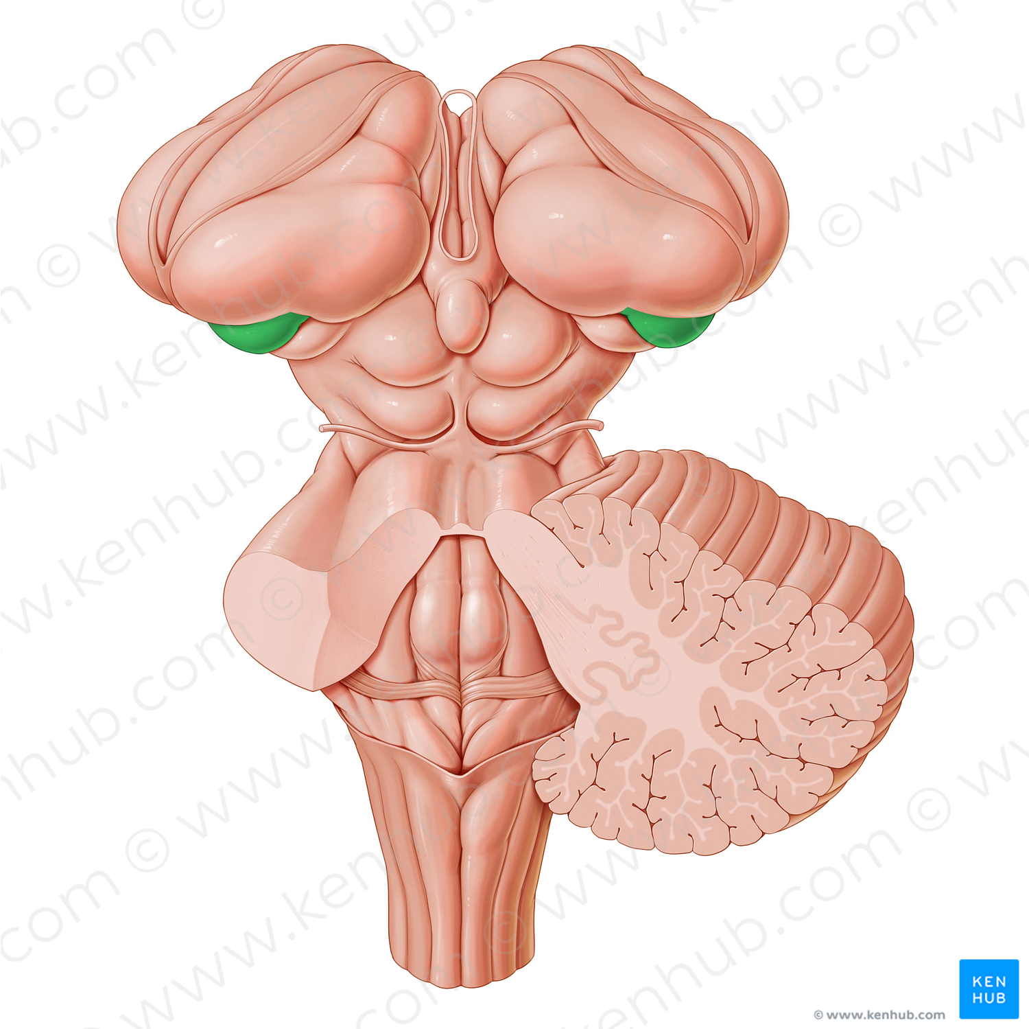 Lateral geniculate body (#2932)