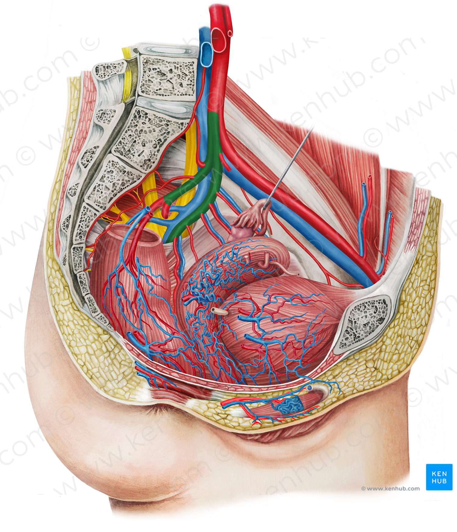 Left internal iliac artery (#1430)