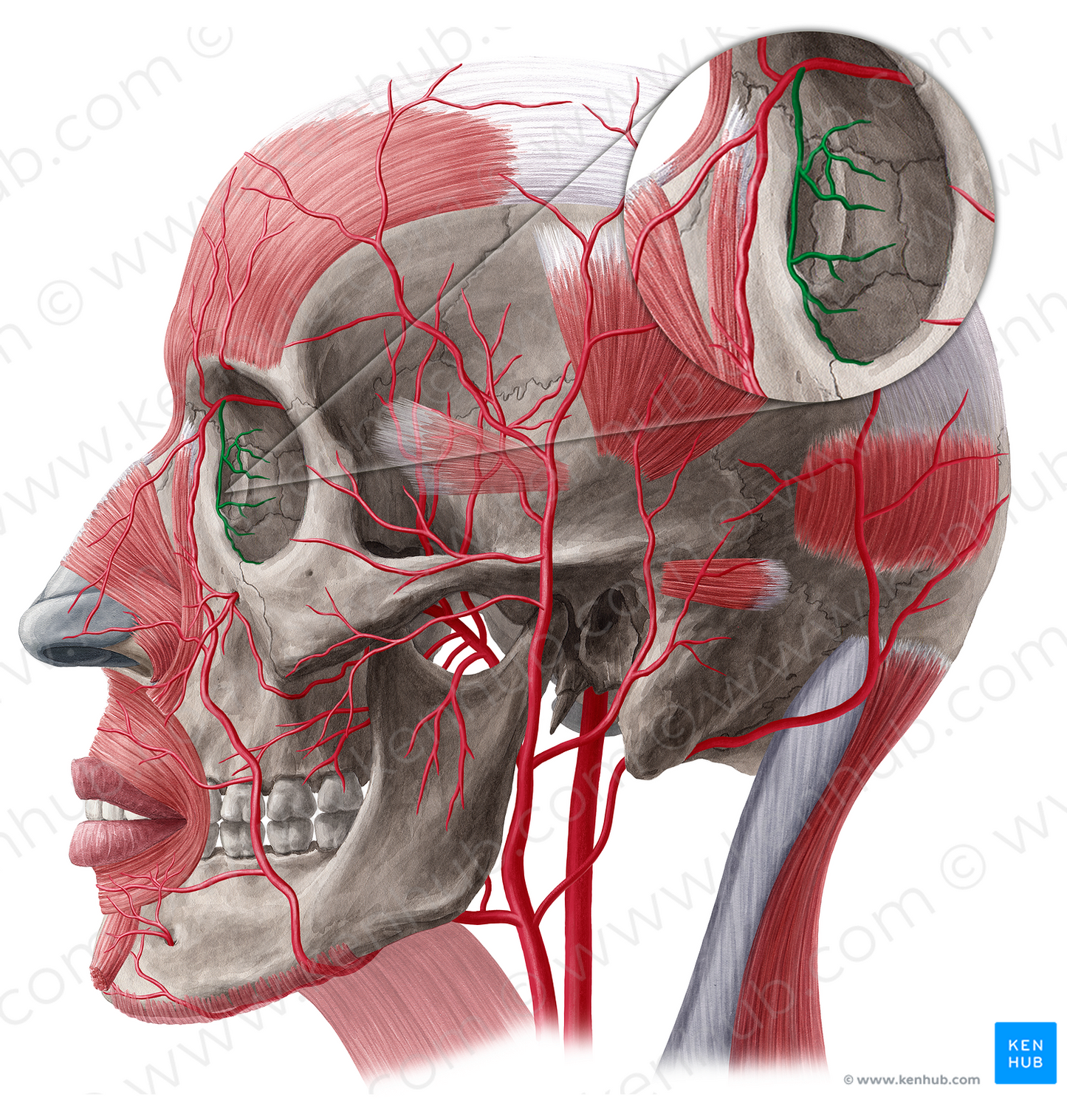 Medial palpebral artery (#20494)