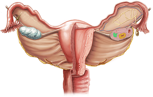 Corpus albicans (#2885)