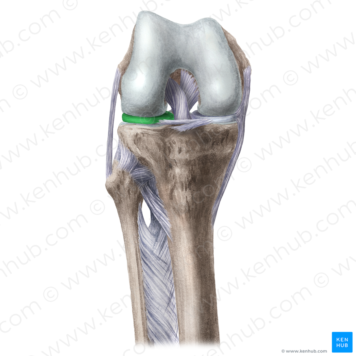 Lateral meniscus (#5061)