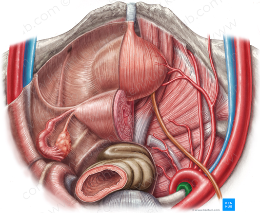 Right internal iliac vein (#10320)