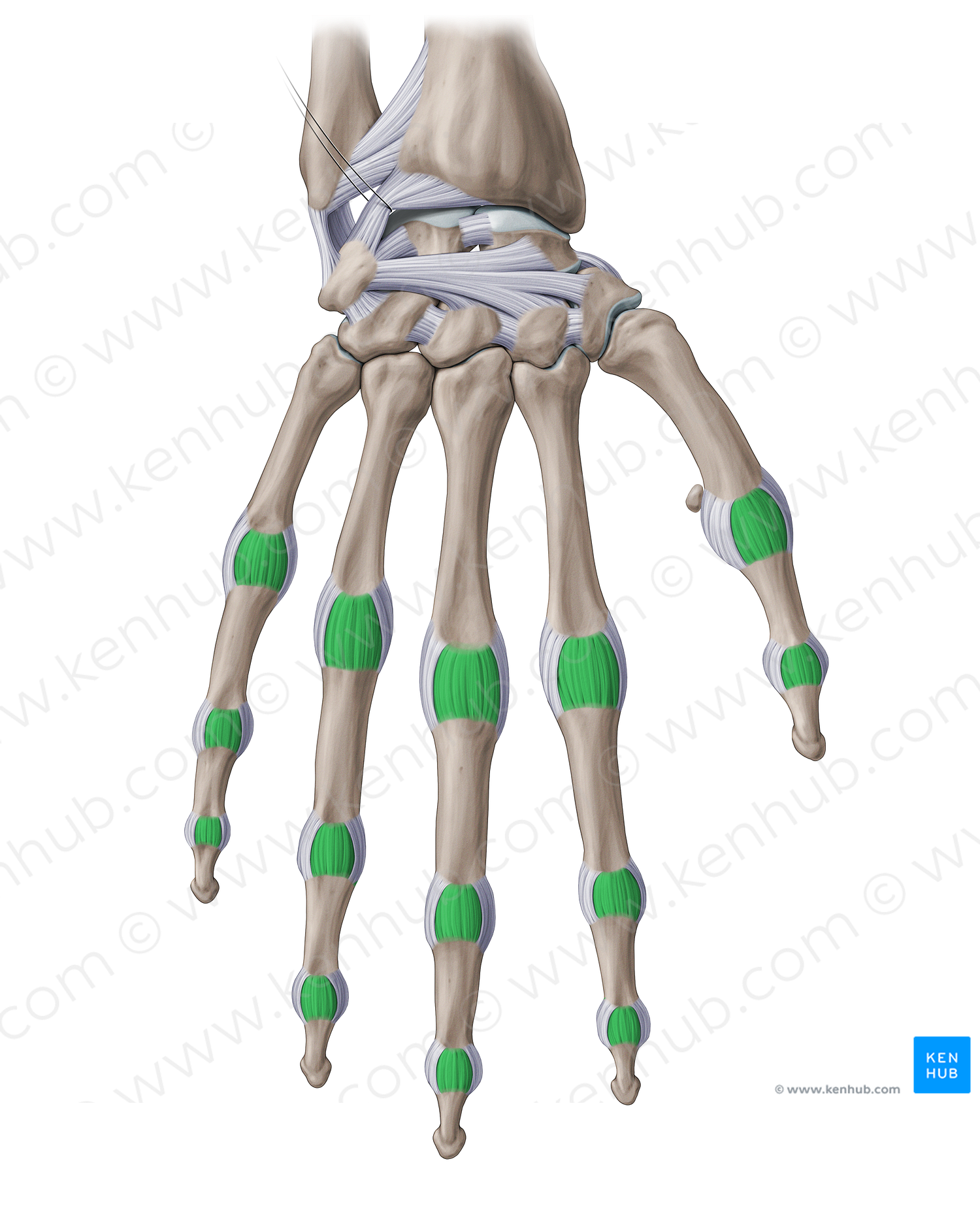 Accessory collateral ligaments of hand (#20978)