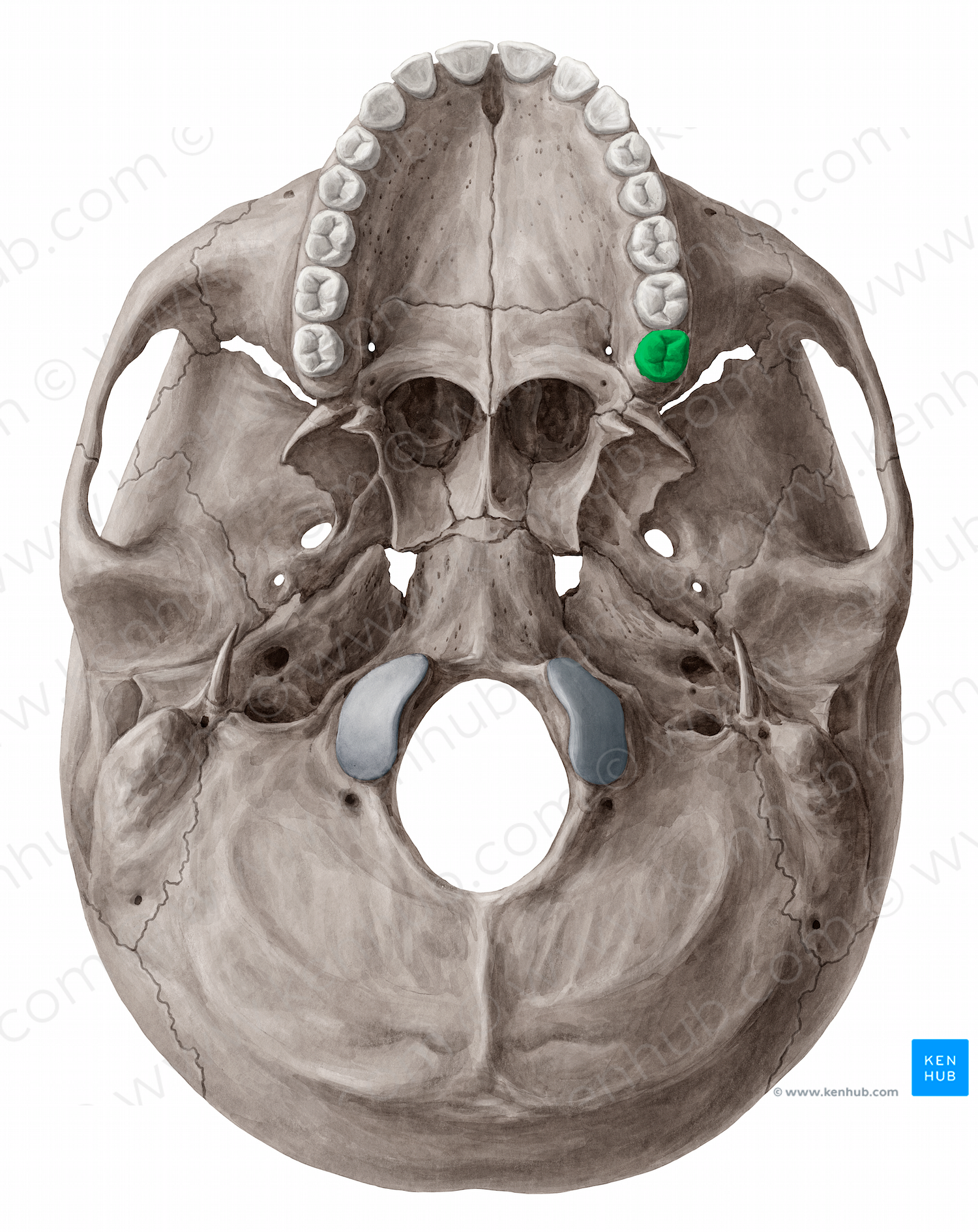 Maxillary left third molar tooth (#12841)