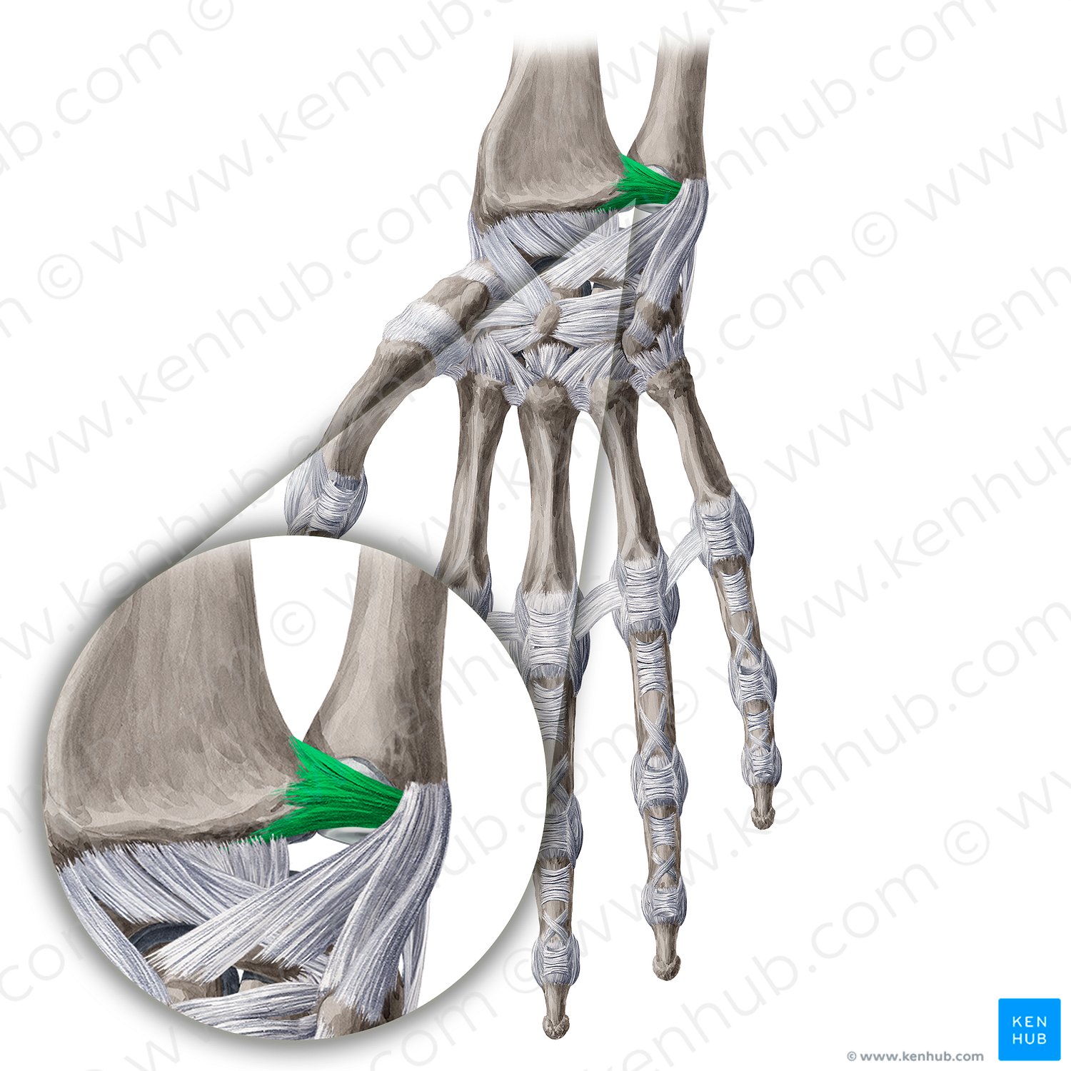 Palmar radioulnar ligament (#4610)