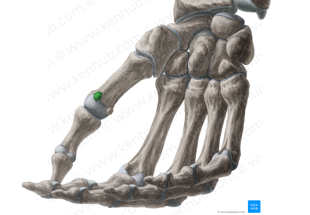 Radial sesamoid bone of metacarpophalangeal joint of thumb (#7506)