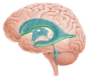 Right lateral ventricle (#10715)