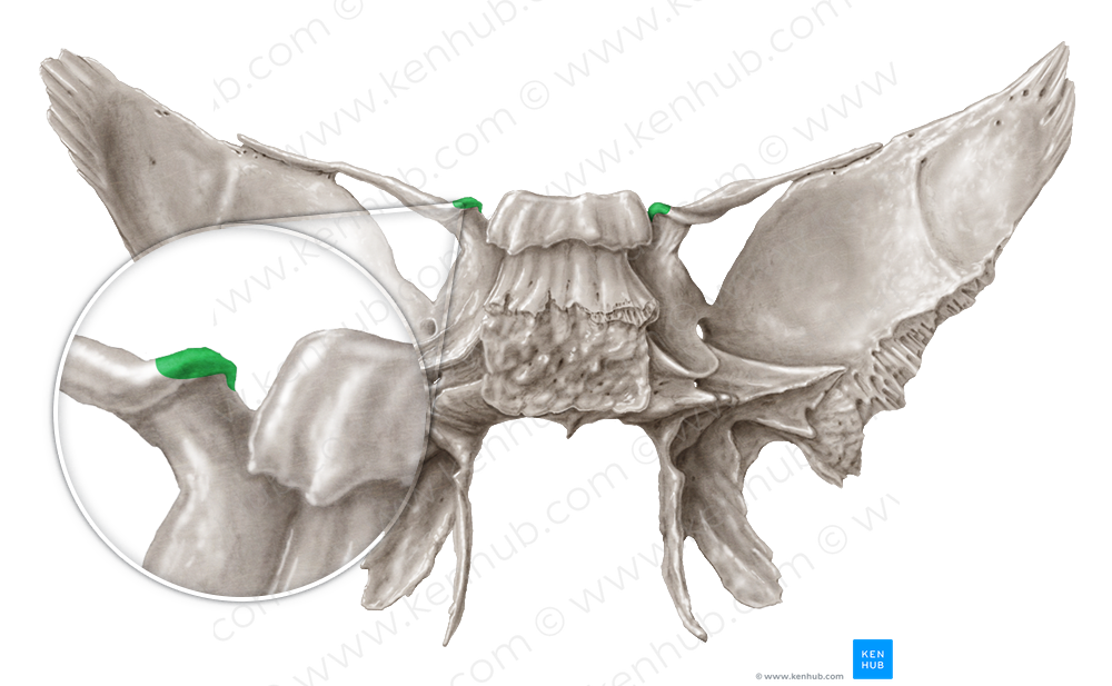 Anterior clinoid process of sphenoid bone (#8184)