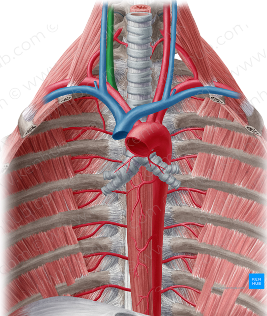 Right common carotid artery (#941)