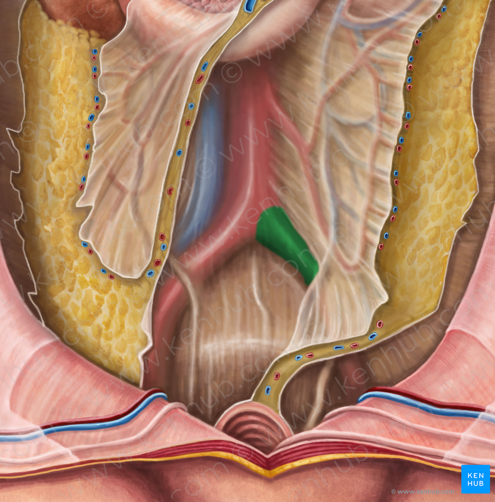 Left common iliac artery (#1387)