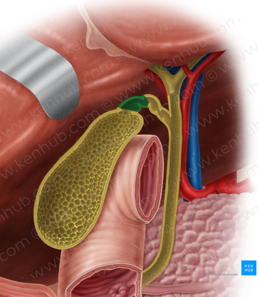 Neck of gallbladder (#2698)