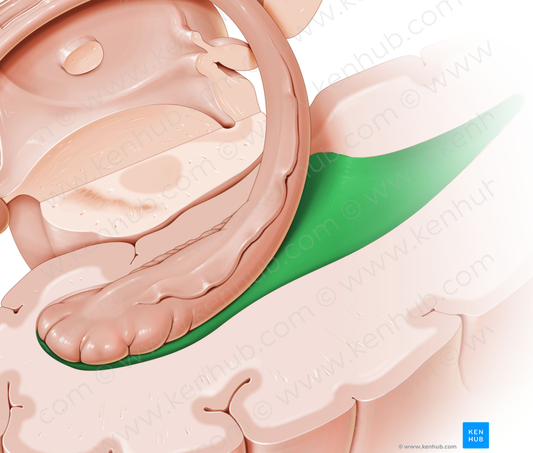 Lateral ventricle (#10709)