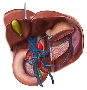 Superior mesenteric artery (#1528)