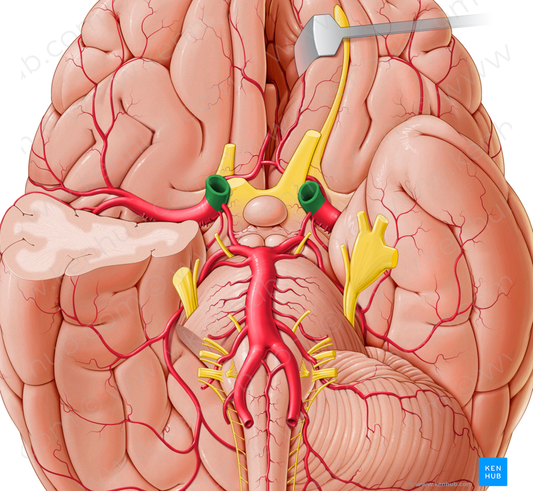 Internal carotid artery (#984)