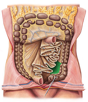 Sigmoid mesocolon (#5080)