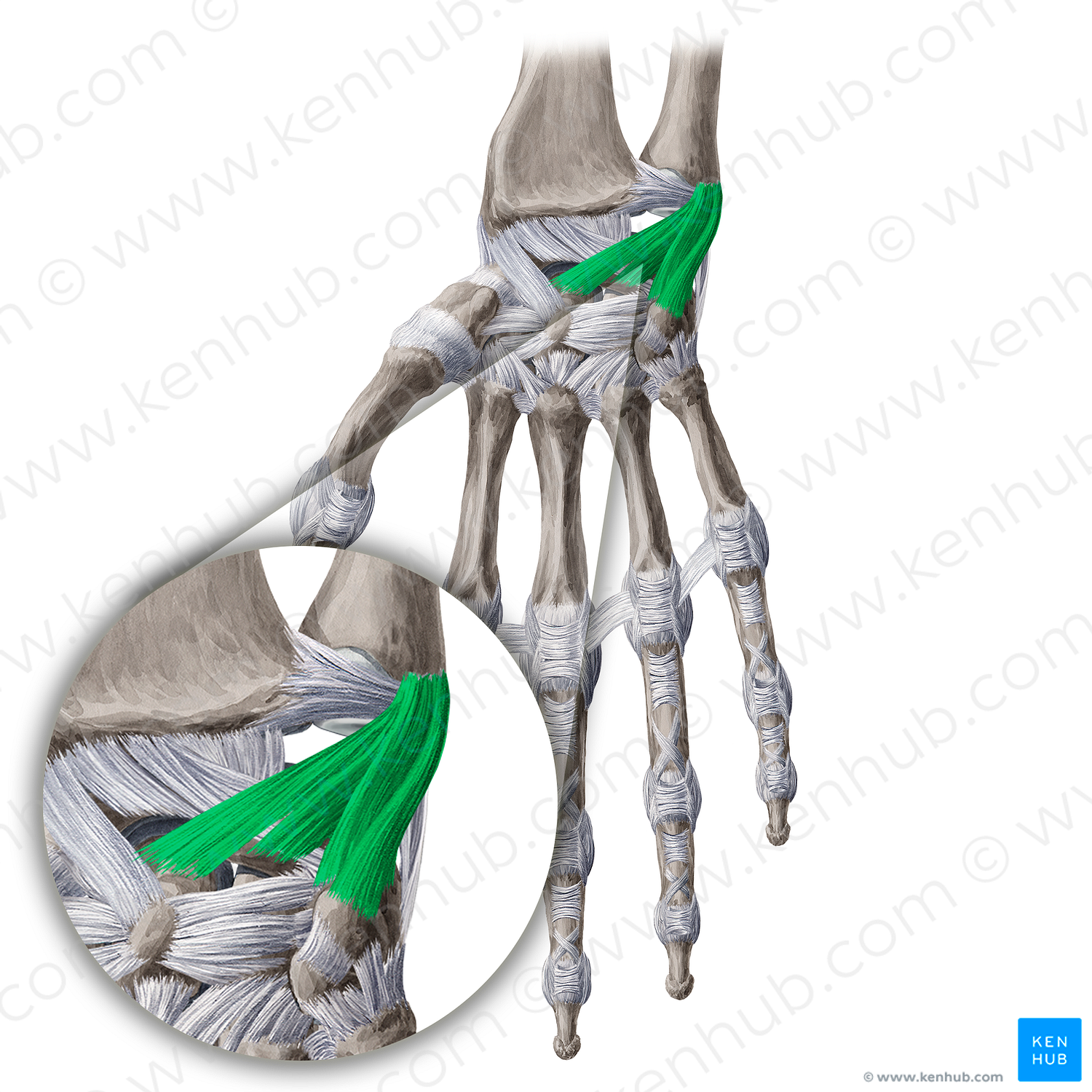 Palmar ulnocarpal ligament (#4671)