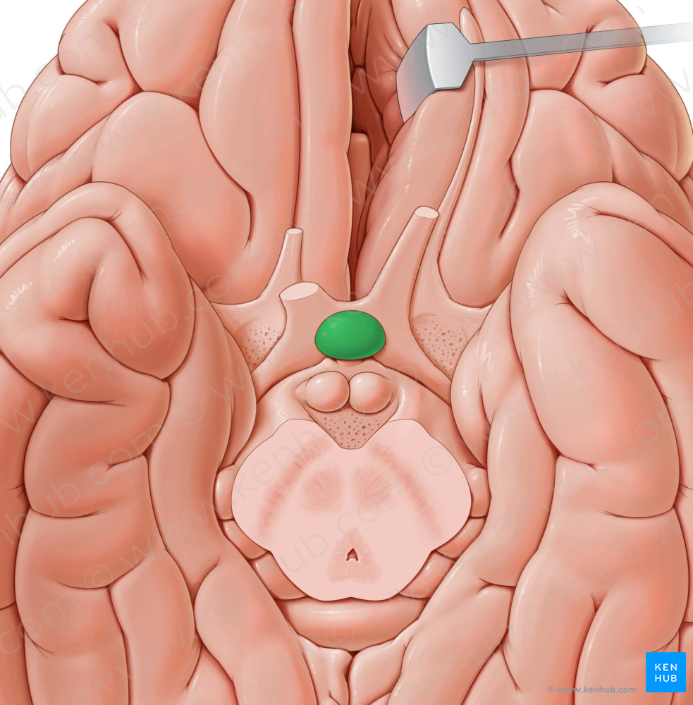 Pituitary gland (#4100)