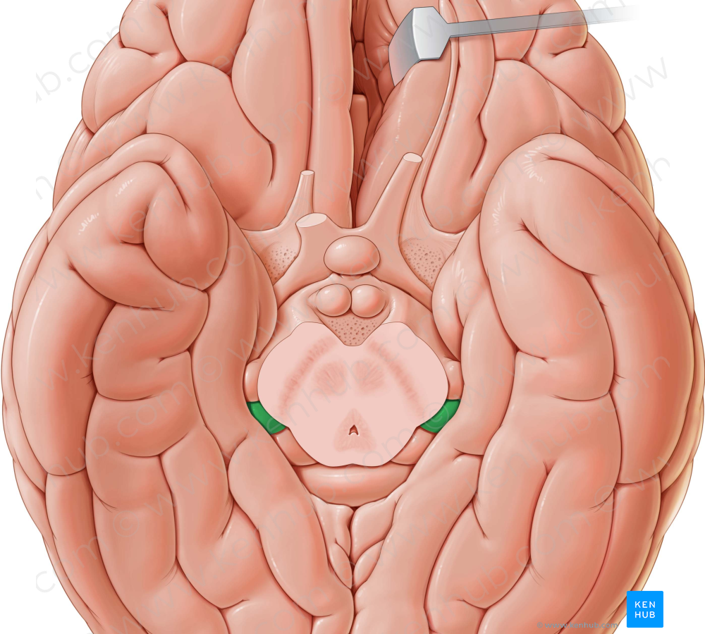 Medial geniculate body (#2948)