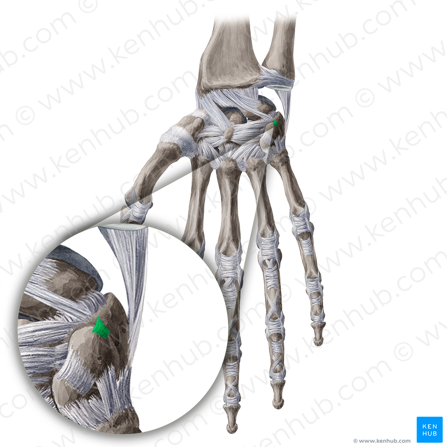 Pisotriquetral ligament (#20965)