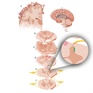 Lateral cervical nucleus (#12091)