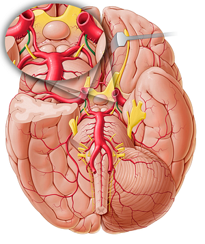 Anterior choroidal artery (#1027)