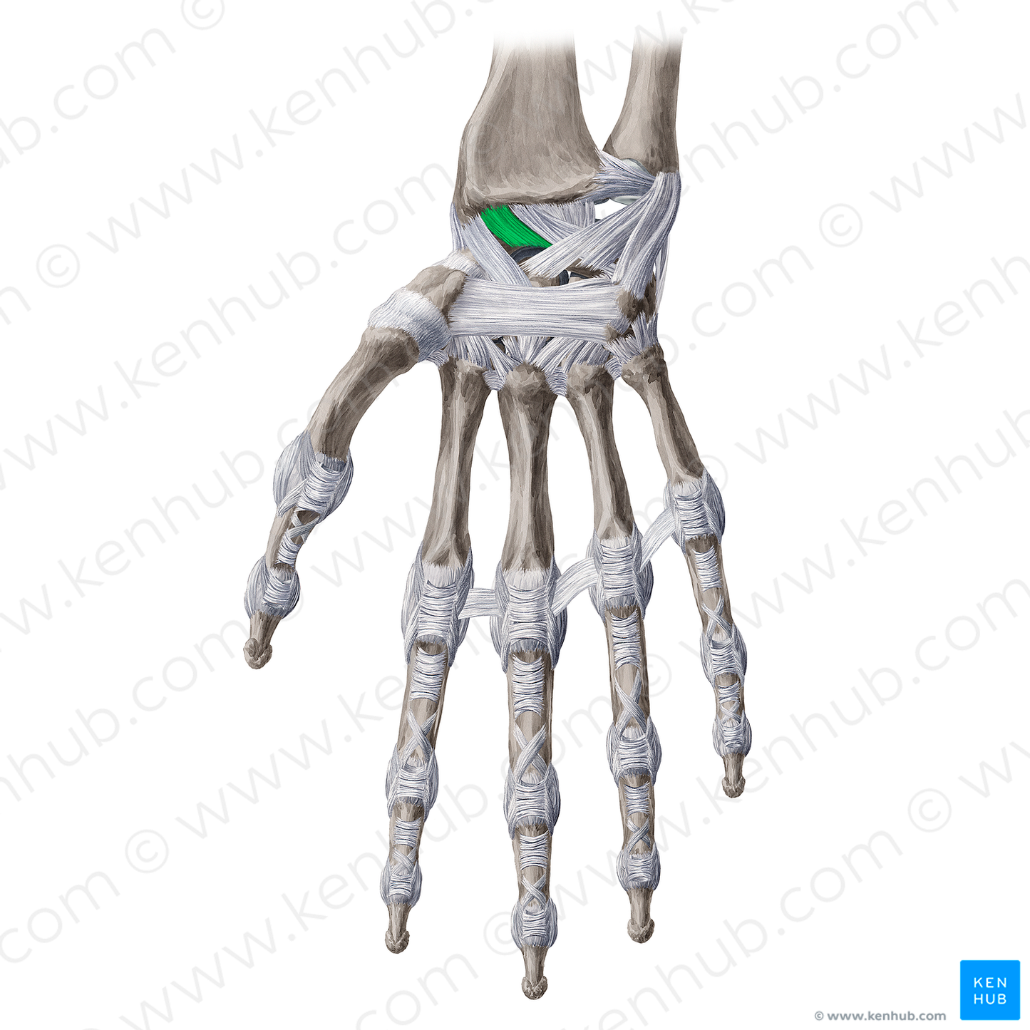 Radioscapholunate ligament (#20659)