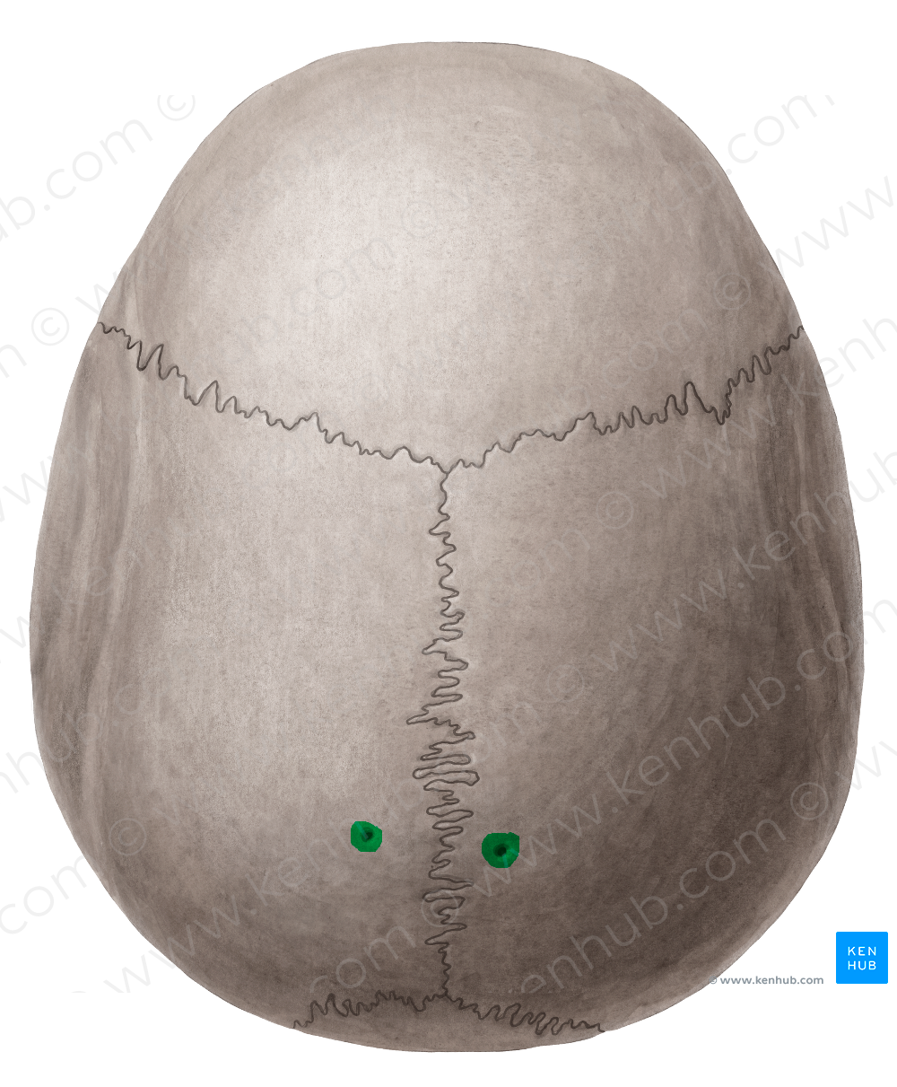 Parietal foramen (#3797)