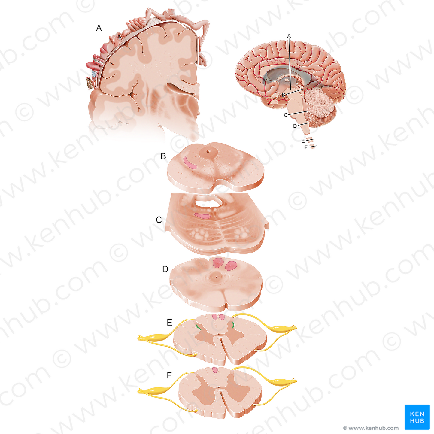 Lateral cervical nucleus (#20452)