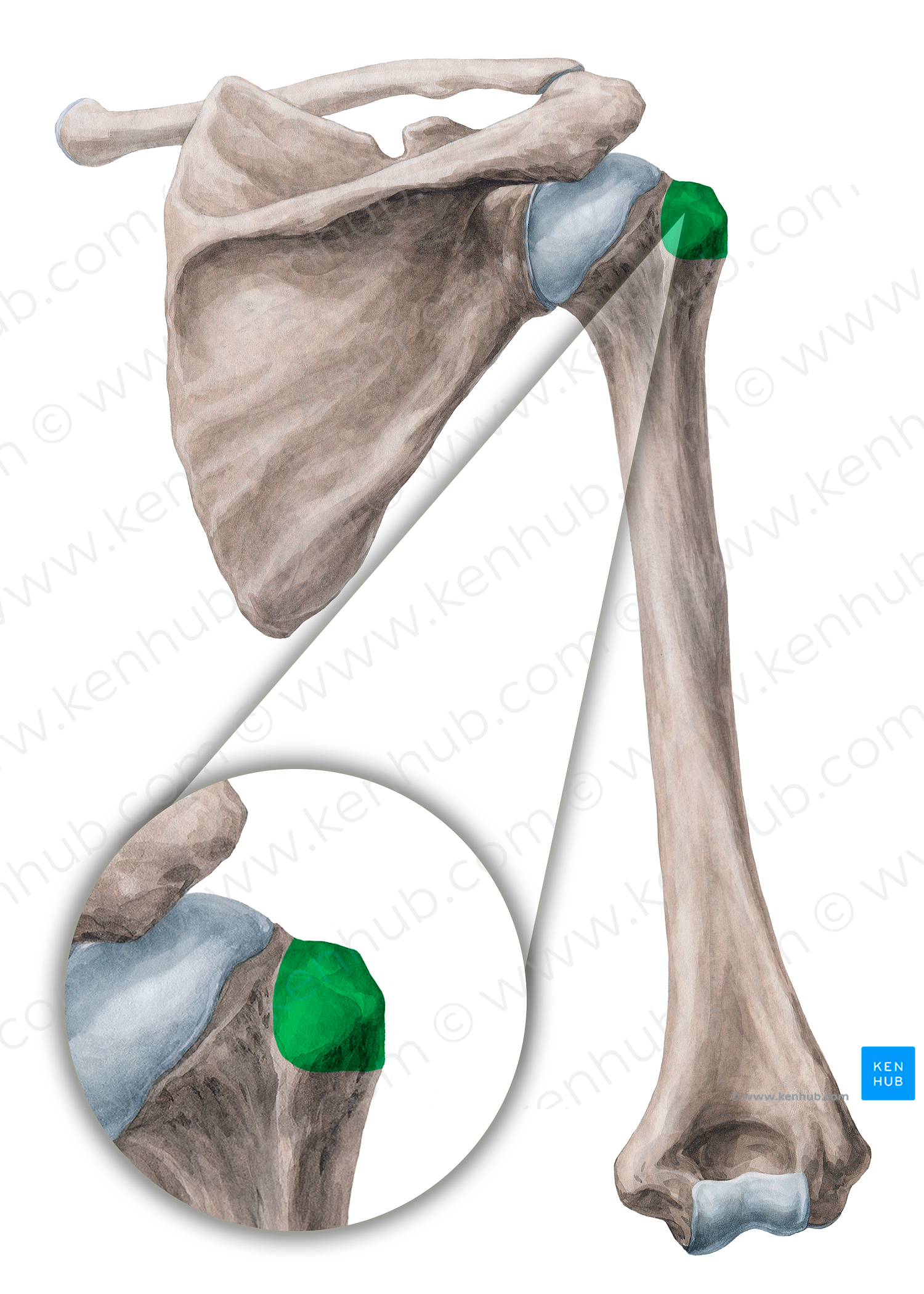 Greater tubercle of humerus (#9732)
