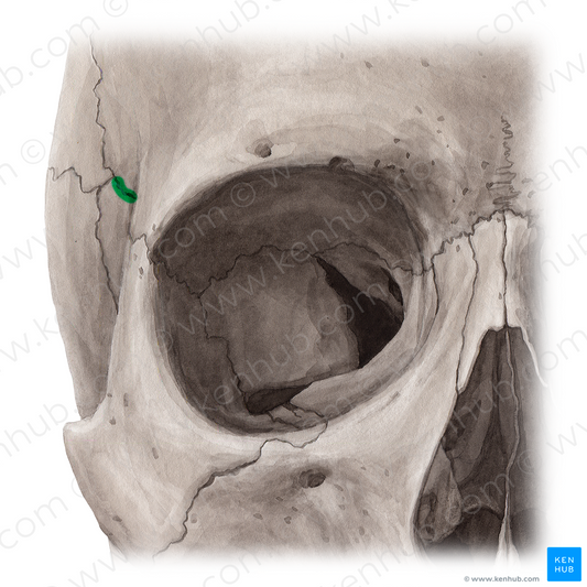 Sphenofrontal suture (#21451)