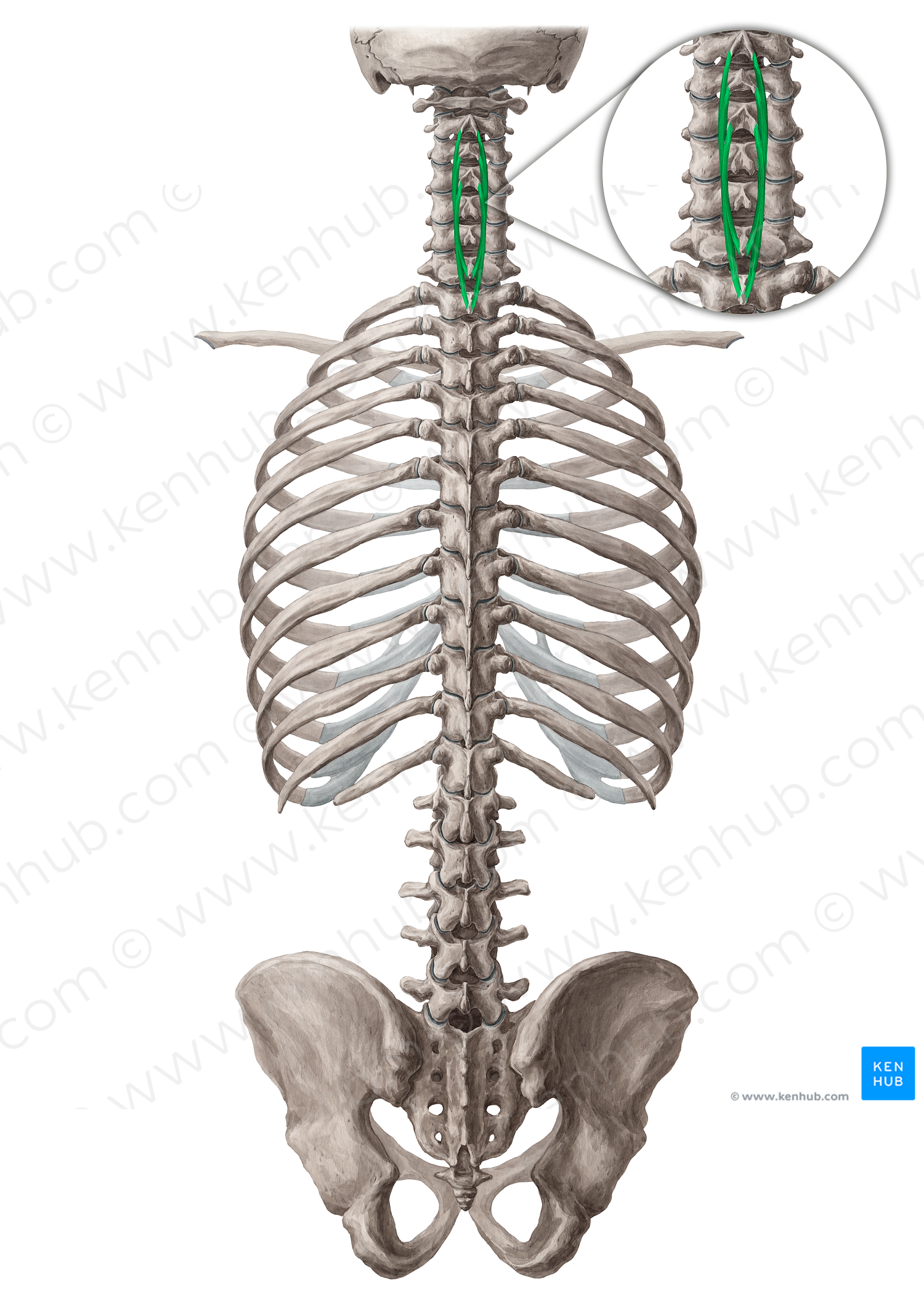 Spinalis cervicis muscle (#19002)